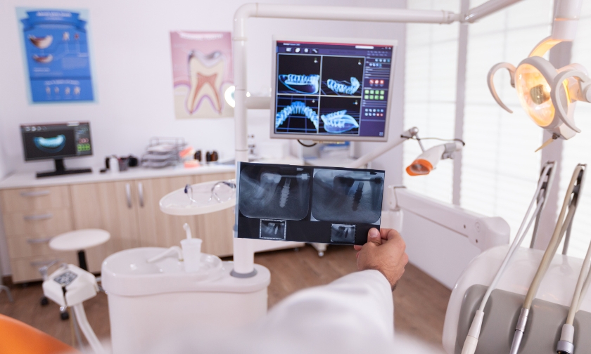 5 Surprising Benefits Of Digital X-Rays You Didn’t Know